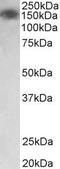 Myosin Light Chain Kinase antibody, TA311559, Origene, Western Blot image 