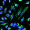 Fibrillarin antibody, M03178-4, Boster Biological Technology, Immunohistochemistry paraffin image 