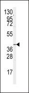 G Protein Subunit Alpha 12 antibody, LS-B9130, Lifespan Biosciences, Western Blot image 