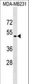 Dentin Matrix Acidic Phosphoprotein 1 antibody, LS-C159466, Lifespan Biosciences, Western Blot image 