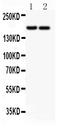 Laminin Subunit Gamma 1 antibody, PB9142, Boster Biological Technology, Western Blot image 