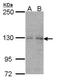 Negative Regulator Of Ubiquitin Like Proteins 1 antibody, GTX101870, GeneTex, Western Blot image 