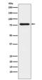 Sad1 And UNC84 Domain Containing 2 antibody, M03291-1, Boster Biological Technology, Western Blot image 