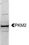 Pyruvate Kinase M1/2 antibody, TA309804, Origene, Western Blot image 