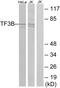 ZFP36 Ring Finger Protein Like 1 antibody, PA5-38755, Invitrogen Antibodies, Western Blot image 