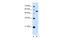 Lectin, Mannose Binding 1 antibody, 30-210, ProSci, Western Blot image 