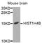 Histone Cluster 4 H4 antibody, STJ110764, St John