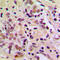 Apoptosis Antagonizing Transcription Factor antibody, LS-C353394, Lifespan Biosciences, Immunohistochemistry paraffin image 
