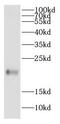 Canopy FGF Signaling Regulator 2 antibody, FNab01815, FineTest, Western Blot image 