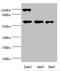 Chaperonin Containing TCP1 Subunit 5 antibody, LS-C675477, Lifespan Biosciences, Western Blot image 