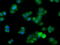 Fumarylacetoacetate Hydrolase Domain Containing 2A antibody, GTX84532, GeneTex, Immunofluorescence image 
