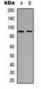 Signal Transducer And Activator Of Transcription 5A antibody, orb334801, Biorbyt, Western Blot image 