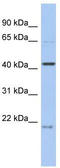Family With Sequence Similarity 98 Member B antibody, TA331400, Origene, Western Blot image 