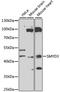 SET And MYND Domain Containing 3 antibody, STJ29448, St John