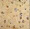 Homer Scaffold Protein 3 antibody, LS-C164968, Lifespan Biosciences, Immunohistochemistry paraffin image 