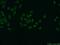 TAR DNA Binding Protein antibody, 18280-1-AP, Proteintech Group, Immunofluorescence image 