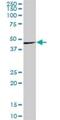 WD Repeat Domain 18 antibody, H00057418-B01P, Novus Biologicals, Western Blot image 