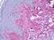 Collagen Type V Alpha 1 Chain antibody, orb95770, Biorbyt, Immunohistochemistry paraffin image 