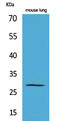 Chymase 1 antibody, STJ96488, St John