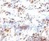 Cyclin Dependent Kinase Inhibitor 1B antibody, V2436IHC-7ML, NSJ Bioreagents, Immunohistochemistry paraffin image 