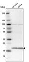 Signal sequence receptor subunit gamma antibody, PA5-53251, Invitrogen Antibodies, Western Blot image 