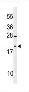 Testis Expressed 12 antibody, LS-C157168, Lifespan Biosciences, Western Blot image 