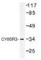 Cytochrome B5 Reductase 3 antibody, AP01486PU-N, Origene, Western Blot image 