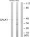 Galactokinase 1 antibody, abx013515, Abbexa, Western Blot image 