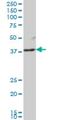 LFNG O-Fucosylpeptide 3-Beta-N-Acetylglucosaminyltransferase antibody, H00003955-M03, Novus Biologicals, Western Blot image 
