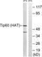 Lysine Acetyltransferase 5 antibody, LS-C118377, Lifespan Biosciences, Western Blot image 