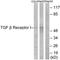 Transforming Growth Factor Beta Receptor 1 antibody, TA312163, Origene, Western Blot image 