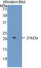 ADAM Metallopeptidase With Thrombospondin Type 1 Motif 2 antibody, LS-C292577, Lifespan Biosciences, Western Blot image 