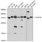 Charged Multivesicular Body Protein 4B antibody, A03385, Boster Biological Technology, Western Blot image 