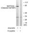 Neurogenic locus notch homolog protein 2 antibody, GTX86911, GeneTex, Western Blot image 