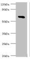 Transglutaminase 2 antibody, A55125-100, Epigentek, Western Blot image 