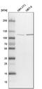 O-Linked N-Acetylglucosamine (GlcNAc) Transferase antibody, HPA030751, Atlas Antibodies, Western Blot image 