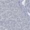 Transmembrane Protein 87A antibody, HPA018104, Atlas Antibodies, Immunohistochemistry paraffin image 