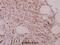 G1 To S Phase Transition 1 antibody, A07761-1, Boster Biological Technology, Immunohistochemistry frozen image 