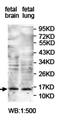 ATP Binding Cassette Subfamily B Member 1 antibody, orb77549, Biorbyt, Western Blot image 