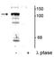 Protein Tyrosine Phosphatase Non-Receptor Type 3 antibody, P06227, Boster Biological Technology, Western Blot image 