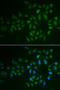 Myosin Light Chain Kinase 3 antibody, STJ28746, St John