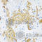 Elastin antibody, A2723, ABclonal Technology, Immunohistochemistry paraffin image 