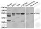 Transcobalamin 2 antibody, A5755, ABclonal Technology, Western Blot image 