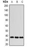 AlkB Homolog 3, Alpha-Ketoglutaratedependent Dioxygenase antibody, abx225026, Abbexa, Western Blot image 