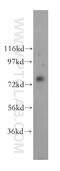 TBC1 Domain Family Member 23 antibody, 17002-1-AP, Proteintech Group, Western Blot image 