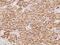 IKAROS Family Zinc Finger 4 antibody, 205653-T08, Sino Biological, Immunohistochemistry paraffin image 