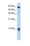 S100 Calcium Binding Protein A3 antibody, NBP1-54679, Novus Biologicals, Western Blot image 