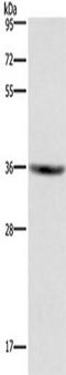 G Protein-Coupled Receptor 171 antibody, TA351231, Origene, Western Blot image 