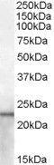 Lipocalin 2 antibody, GTX88841, GeneTex, Western Blot image 