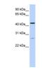 Acyl-CoA Binding Domain Containing 5 antibody, NBP1-59821, Novus Biologicals, Western Blot image 